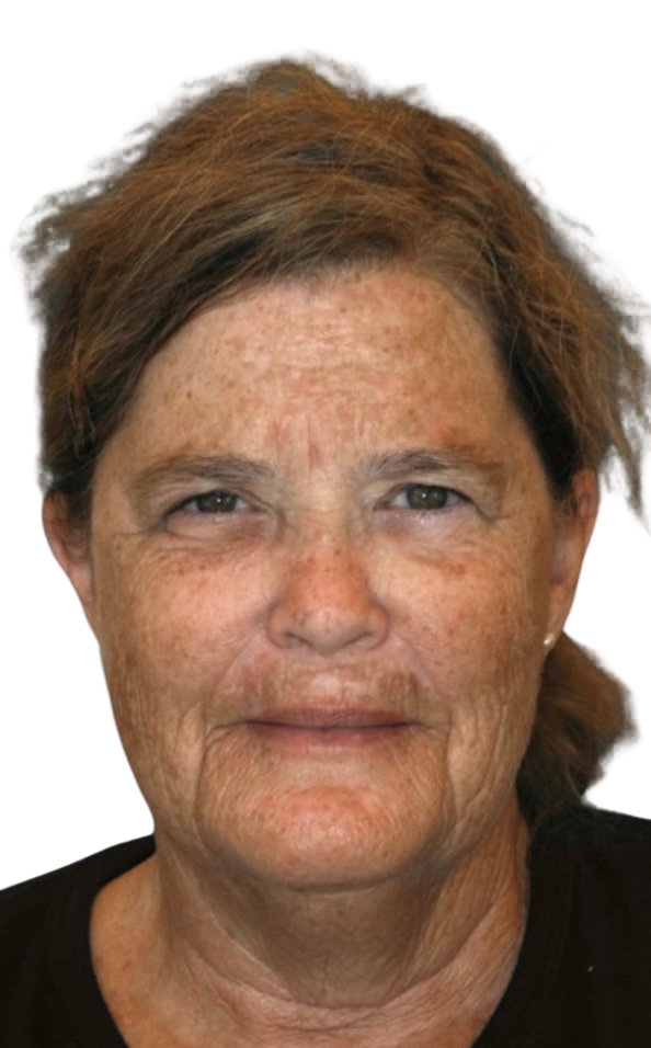 Extrinsic Ageing Leonie Thorne Skin Studio Southampton