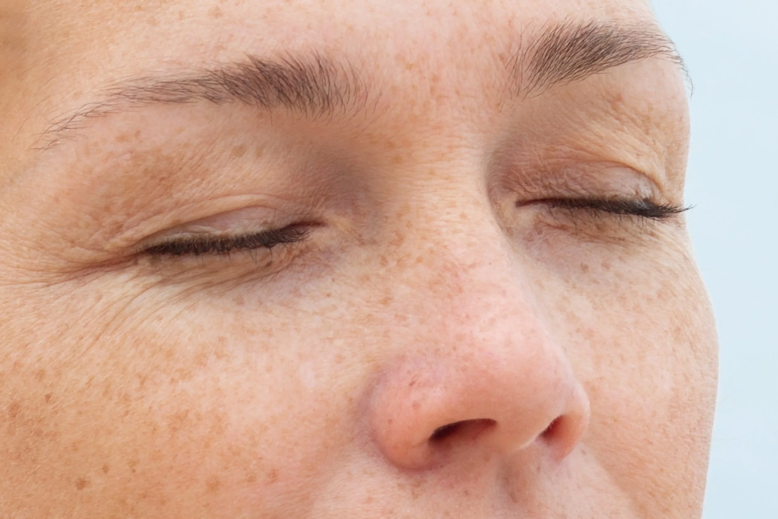 UV Damage Leonie Thorne Skin Studio Southampton