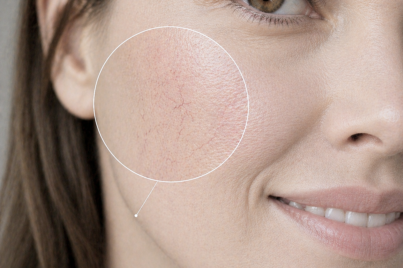close up woman face cheek thread veins magnifying glass smile
