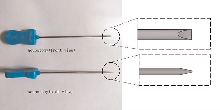 Acupotomy (aka Knife Needle Technique)