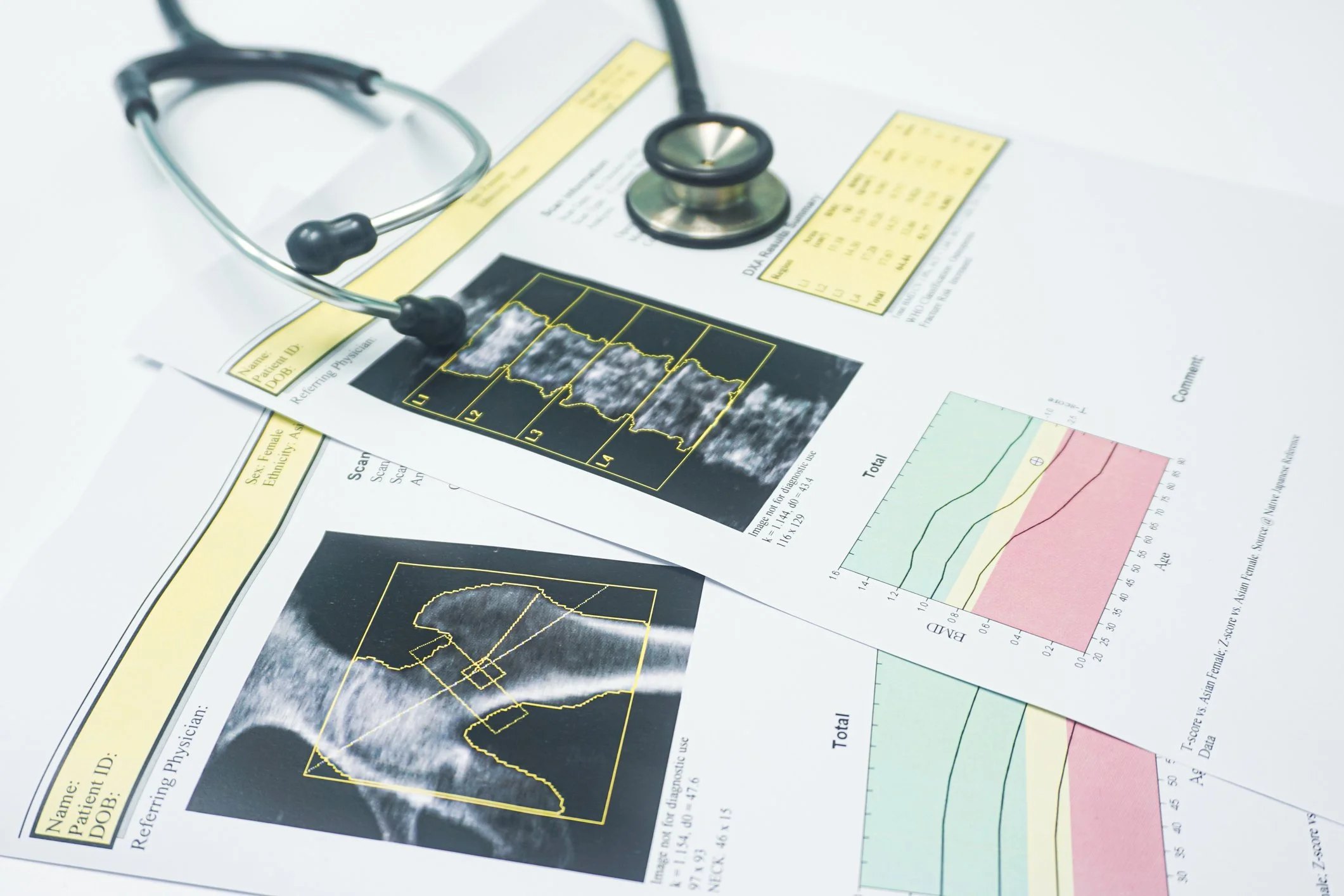 DEXA and Bone Health
