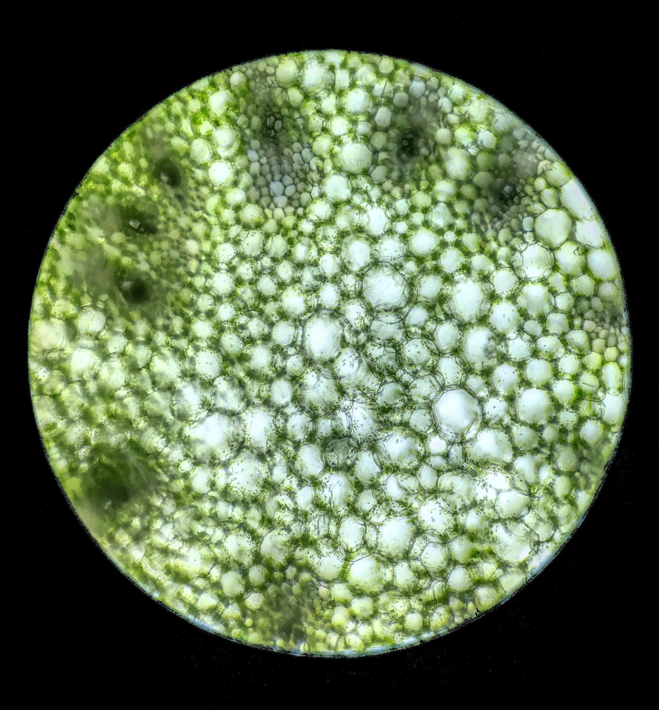Close-up view of a circular green cacti with numerous small, white, rounded bumps and thorny structures, contrasting against a black background.