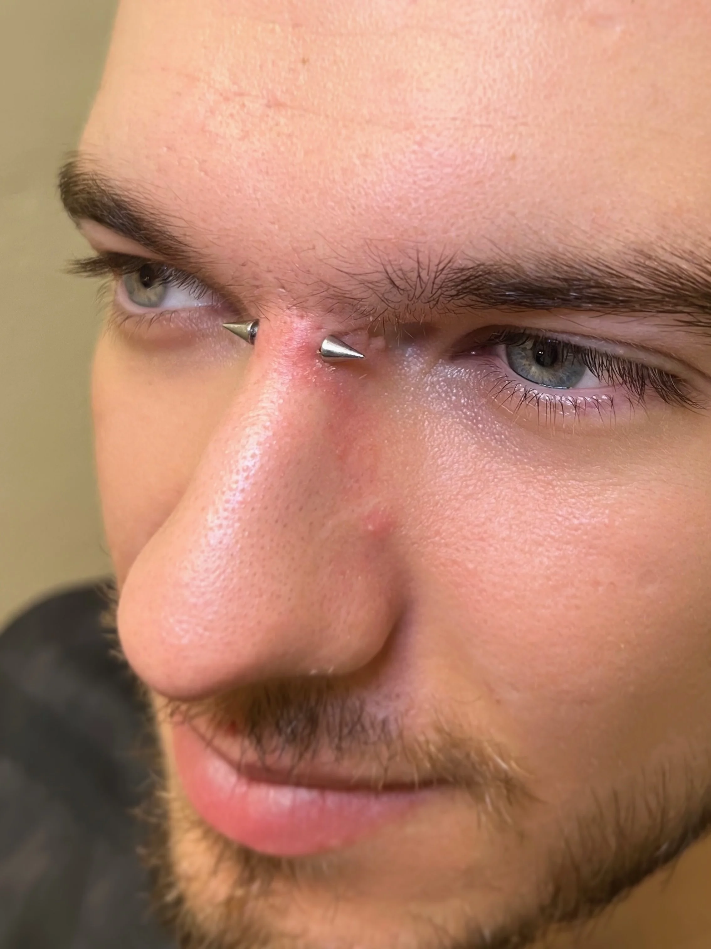 Actualizaci&oacute;n de un Bridge Piercing 😎

Realizado hace m&aacute;s de 6 meses y hoy nos visita para una revisi&oacute;n y cambio de joya. La evoluci&oacute;n va estupenda 👌

Cuando el piercing est&aacute; bien asentado, tambi&eacute;n podemos 