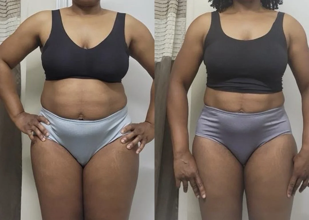 Side-by-side comparison of a woman before and after weight loss, wearing a black tank top and light gray shorts.