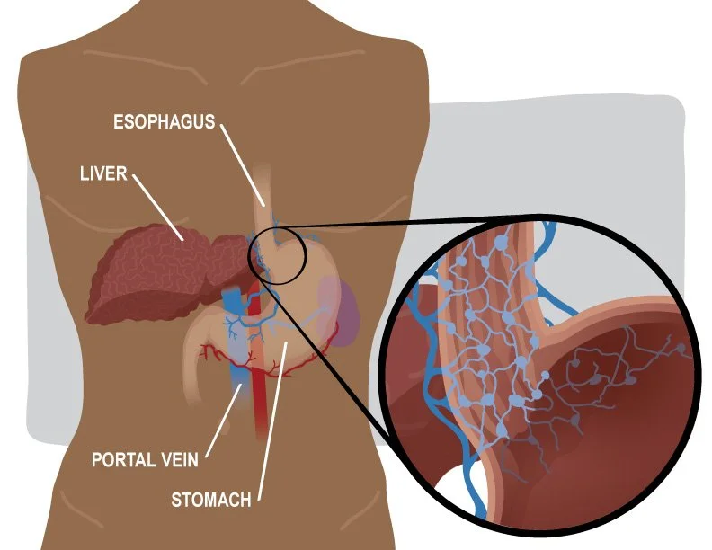 See Medical Illustration