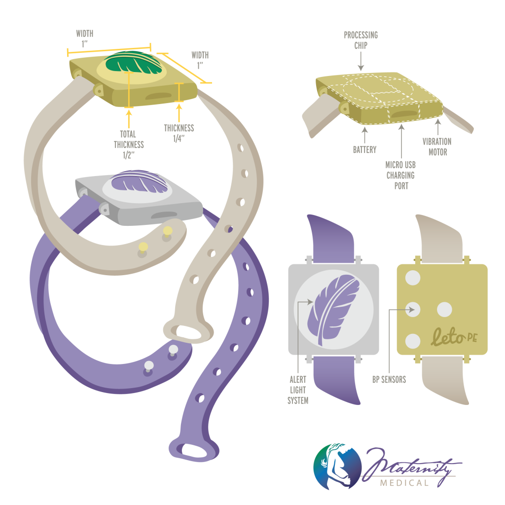 See Technical Illustration