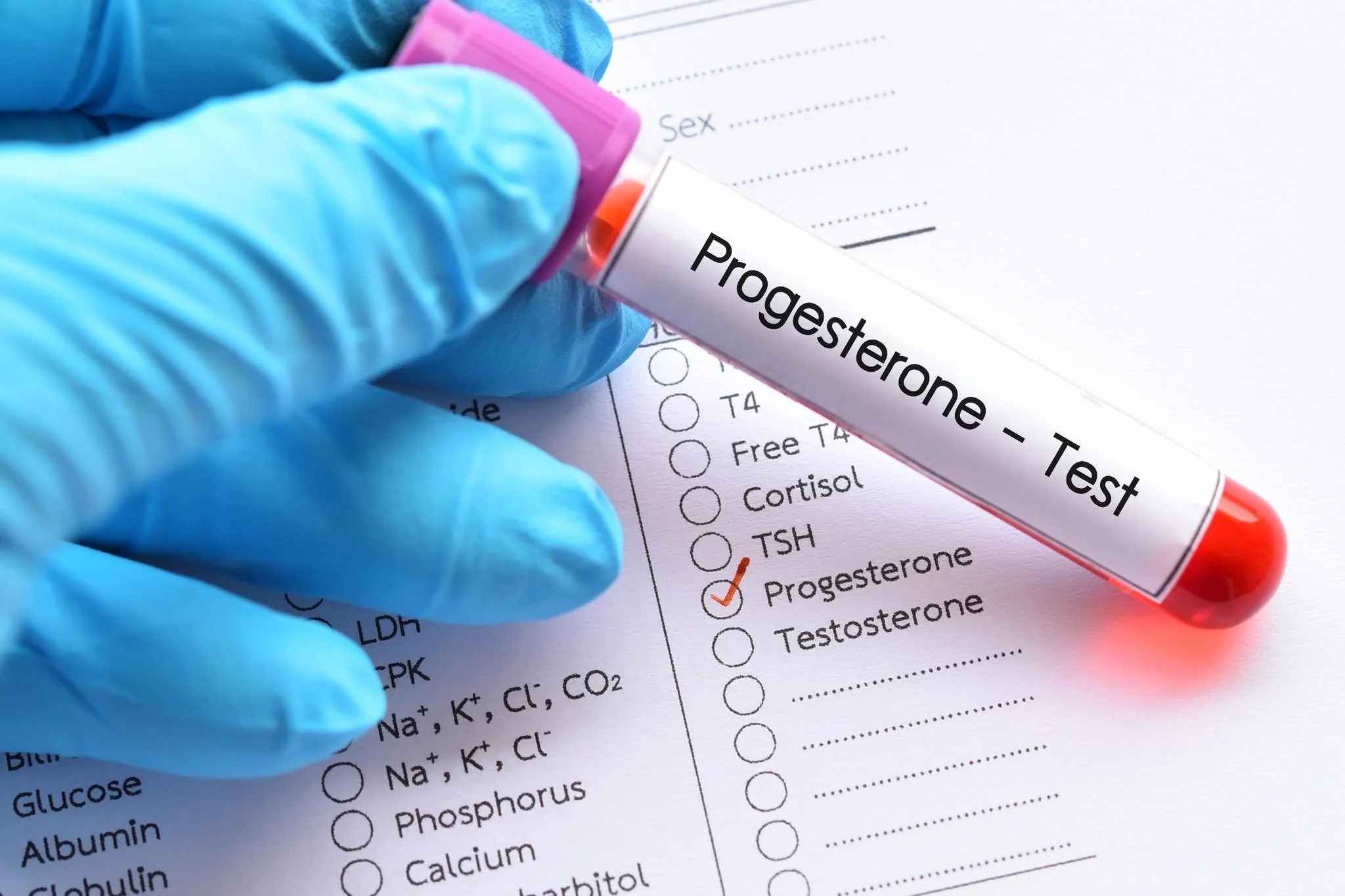 Progesterone Resistance: The Missing Link