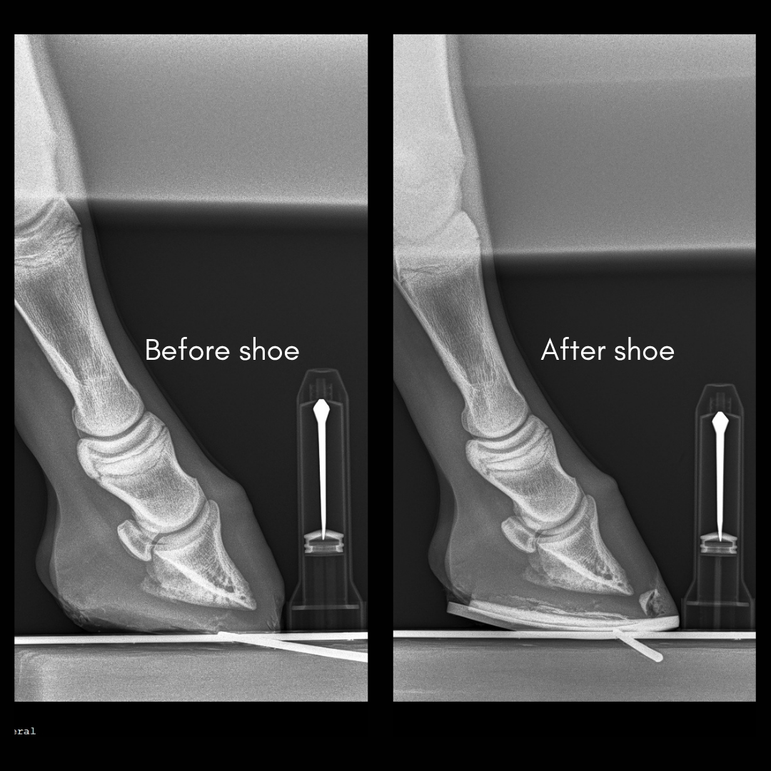 Grace’s Hoof: A New Shoe and a More Protective Phase of Recovery