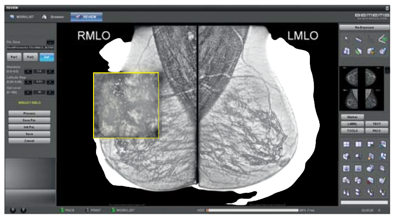 Bemems Pinkview DR Prime BG2.png