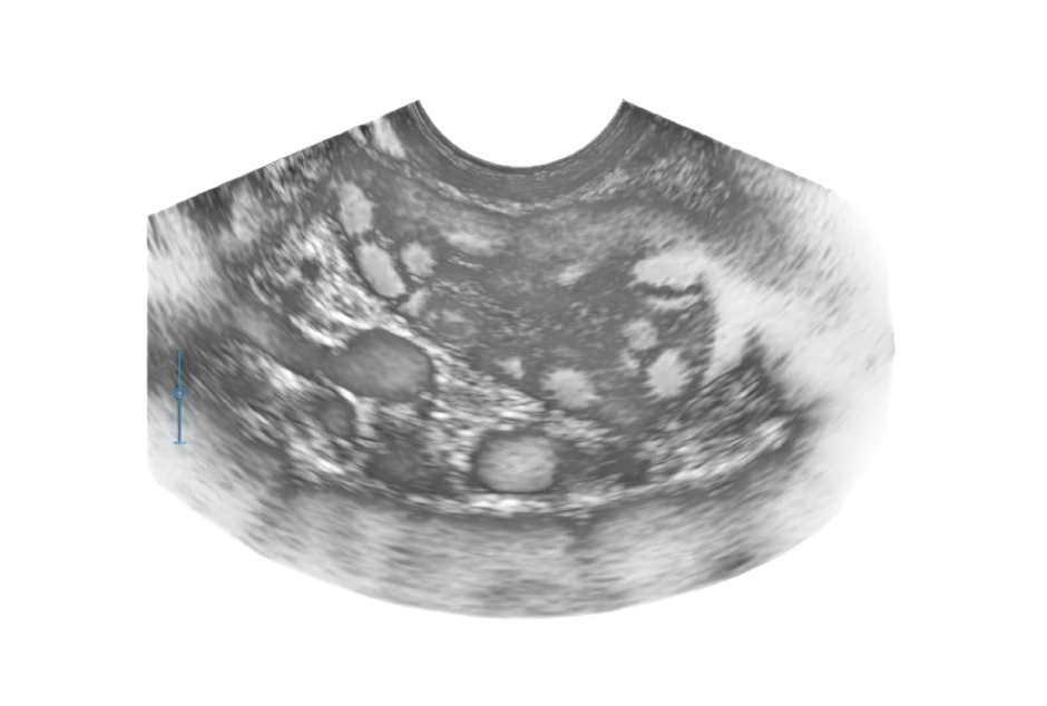 Screenshot 2026-03-22 at 8.03.09 PM-Photoroom.png