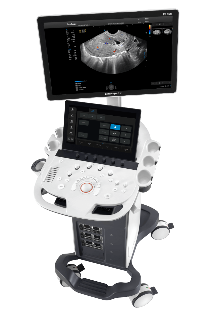 P9 Elite Ultrasound