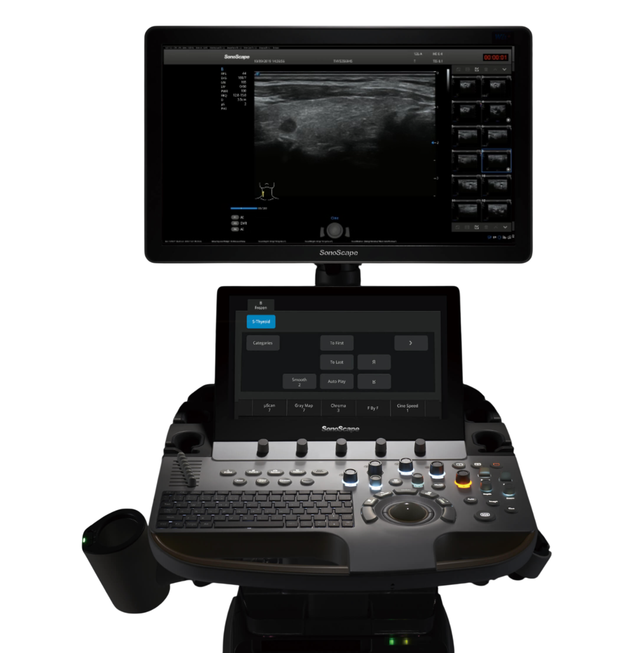 Sonoscape P60 Ultrasound