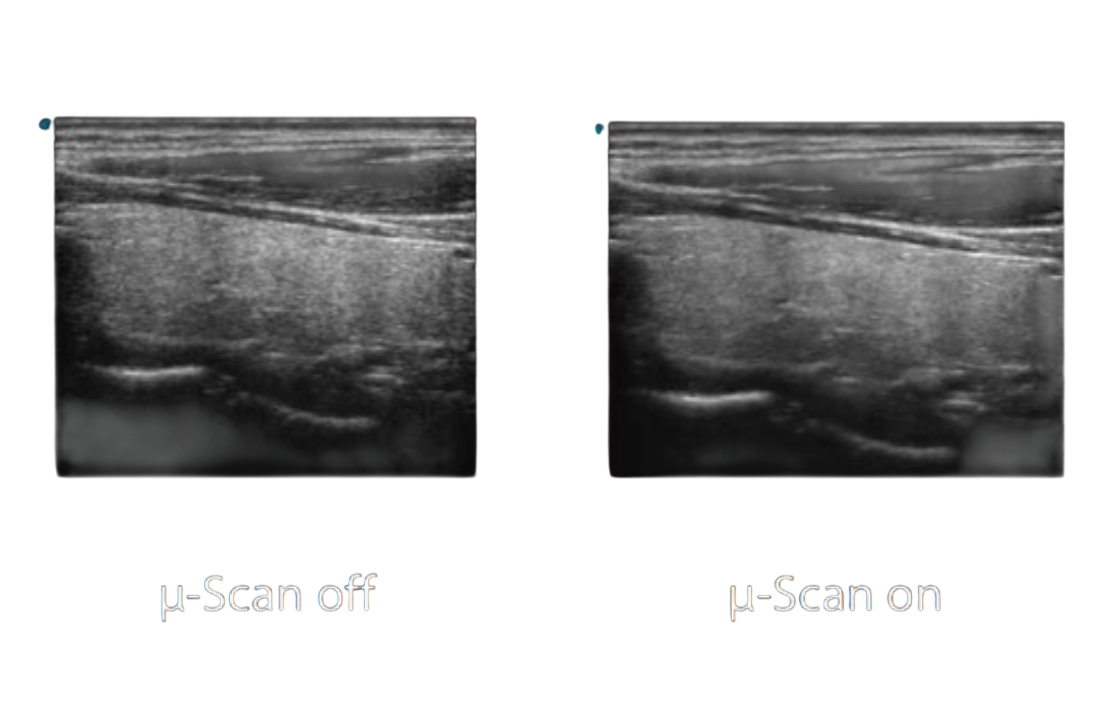 Screenshot 2026-03-22 at 8.11.33 PM-Photoroom.png