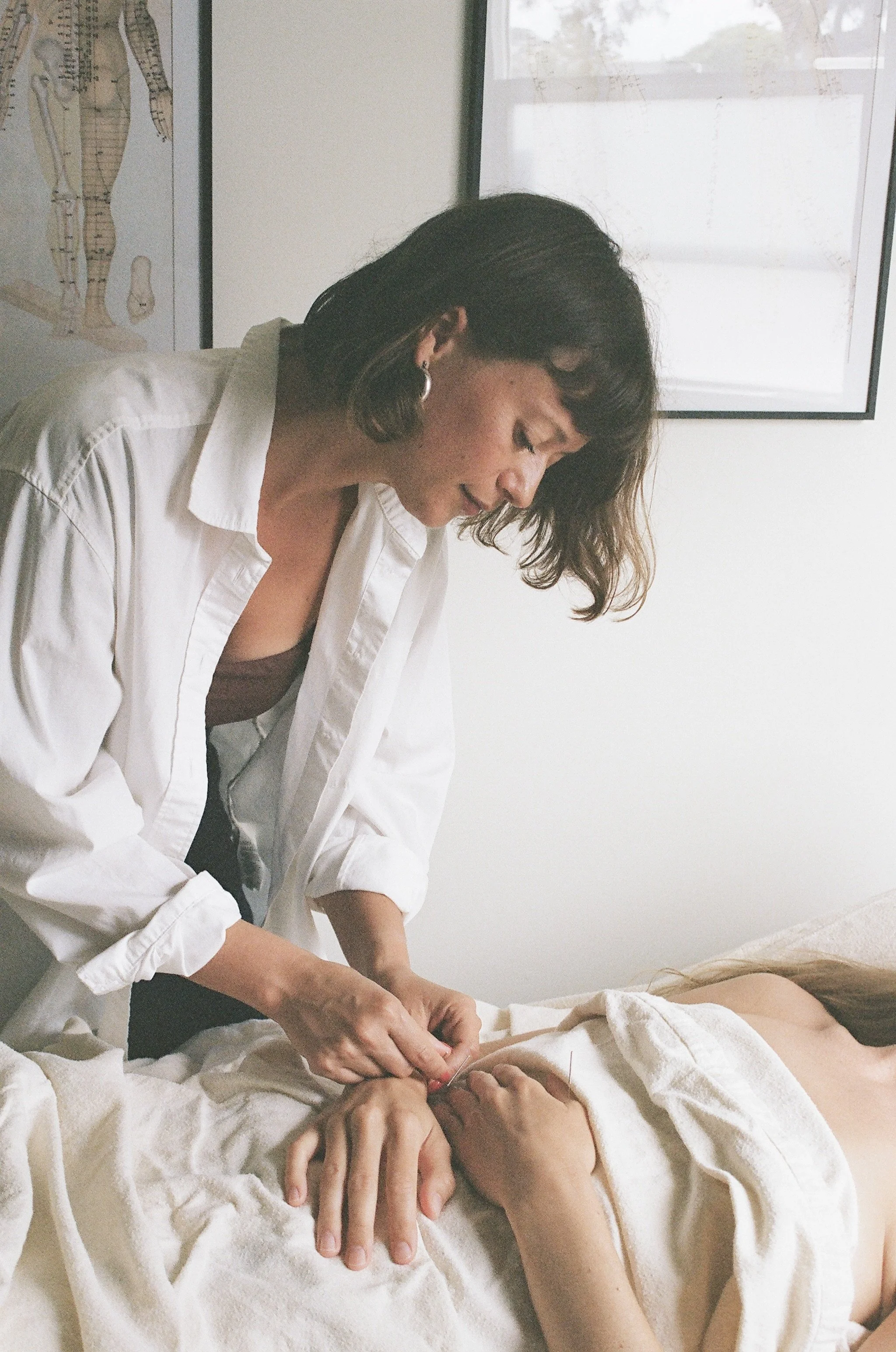 A woman practicing acupuncture or medical treatment on a person lying on a bed, with medical charts on the wall and a window in the background.