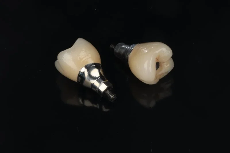 Dental Implants