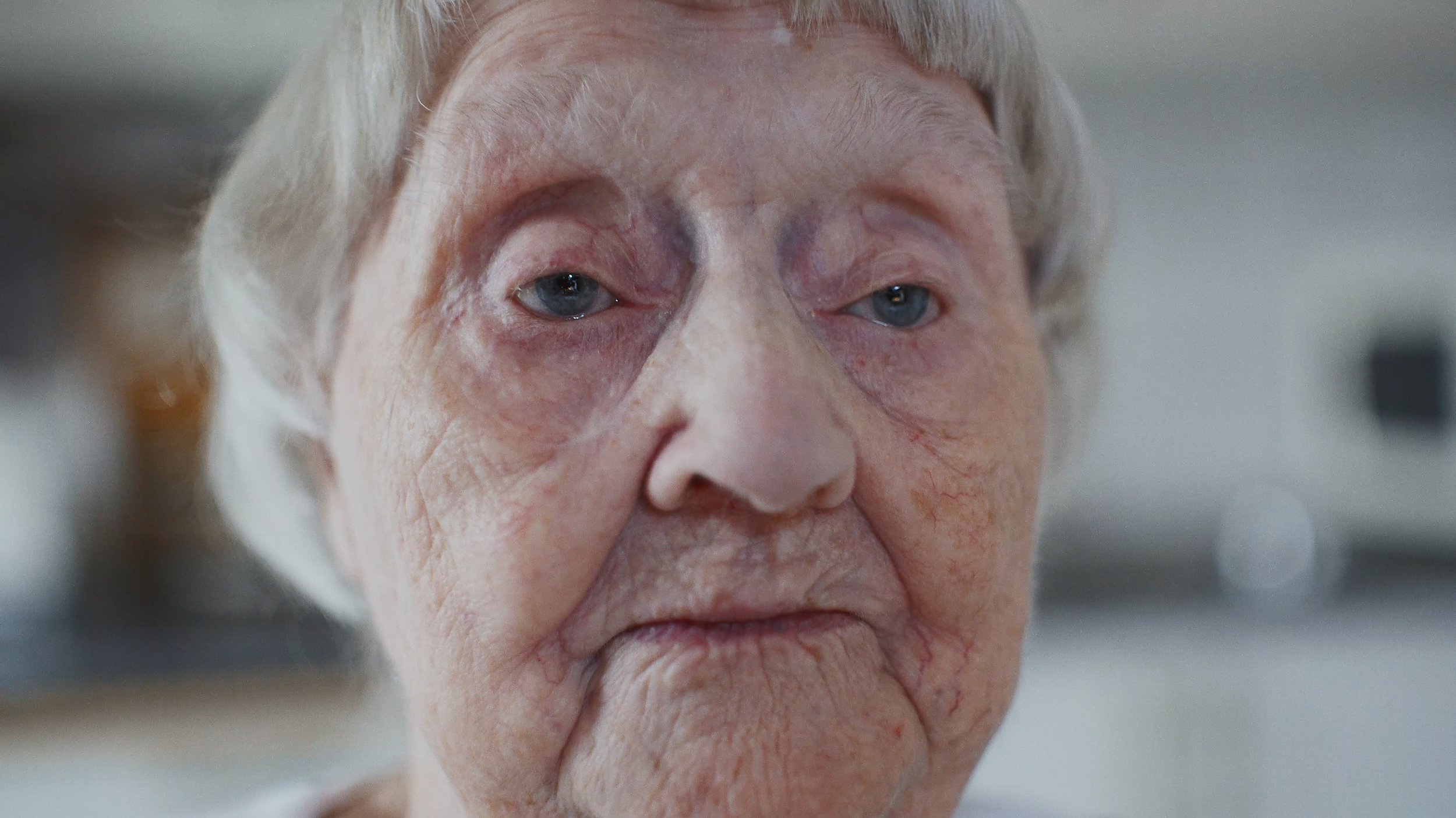 Nærbillede af en ældre kvindes ansigt med tydelige træk og rynker | Dokumentarfilm | Stemmer fra sær- og åndssvageforsorgen | Anders Mielcke Grønbæk | GESTALT