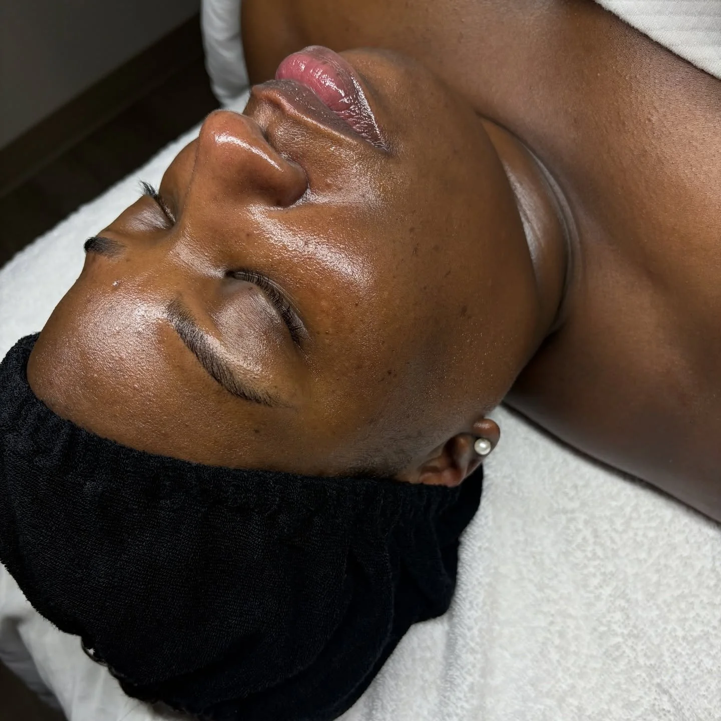 A few treatments later.. 
- Improved tone 
- Increases hydration
- Less pore congestion
- Smoother skin texture

Ready to start your skin care journey? TXT 817-733-3813 to get started

📍2201 N. Collins St, #180, Arlington TX 

#arlingtontx #dfwesthe