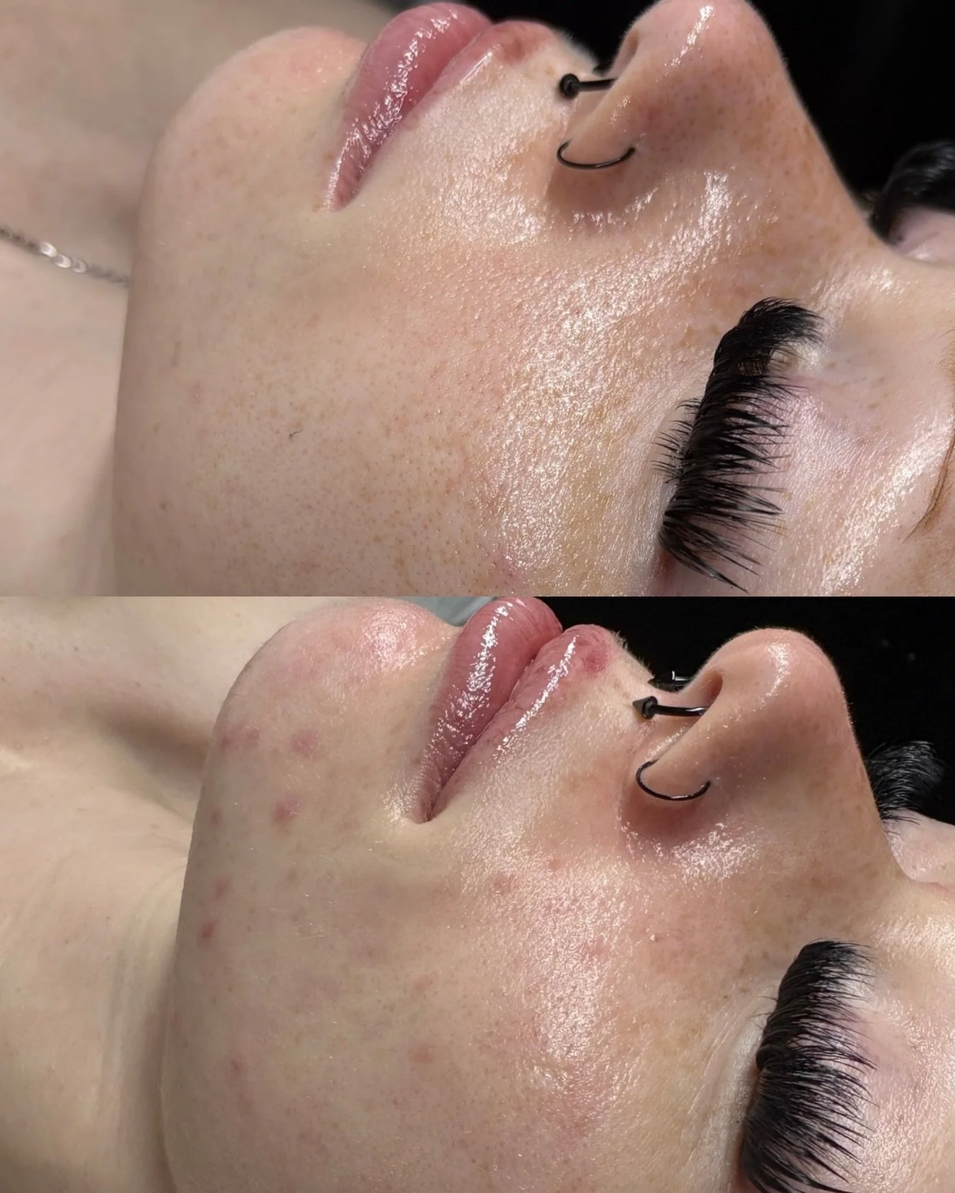 The ✨results✨ speak for themselves!

Bespoke Facial = Curated Skin Experience
Come see the difference!

www.tahirahelahiesthetics.com

#dfwesthetician #dfwspa