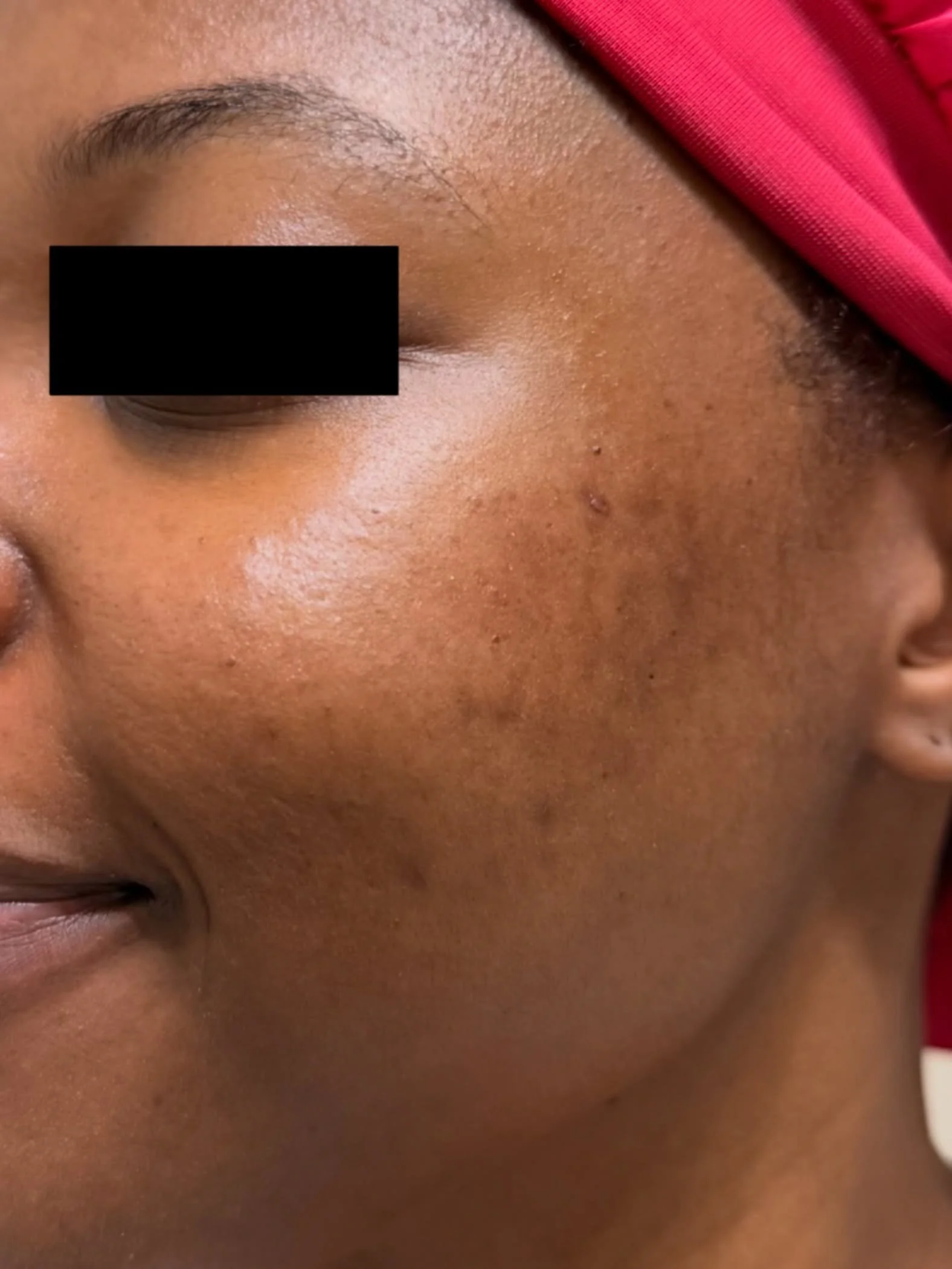 ✨ Virtual Client Check-In ✨
Having a curated skincare routine is sometimes all you need..
800 miles away.. this bride-to-be is prepping for her big day 👰🏾&zwj;♀️

My focus is always restoring the barrier and increasing hydration before we move on t