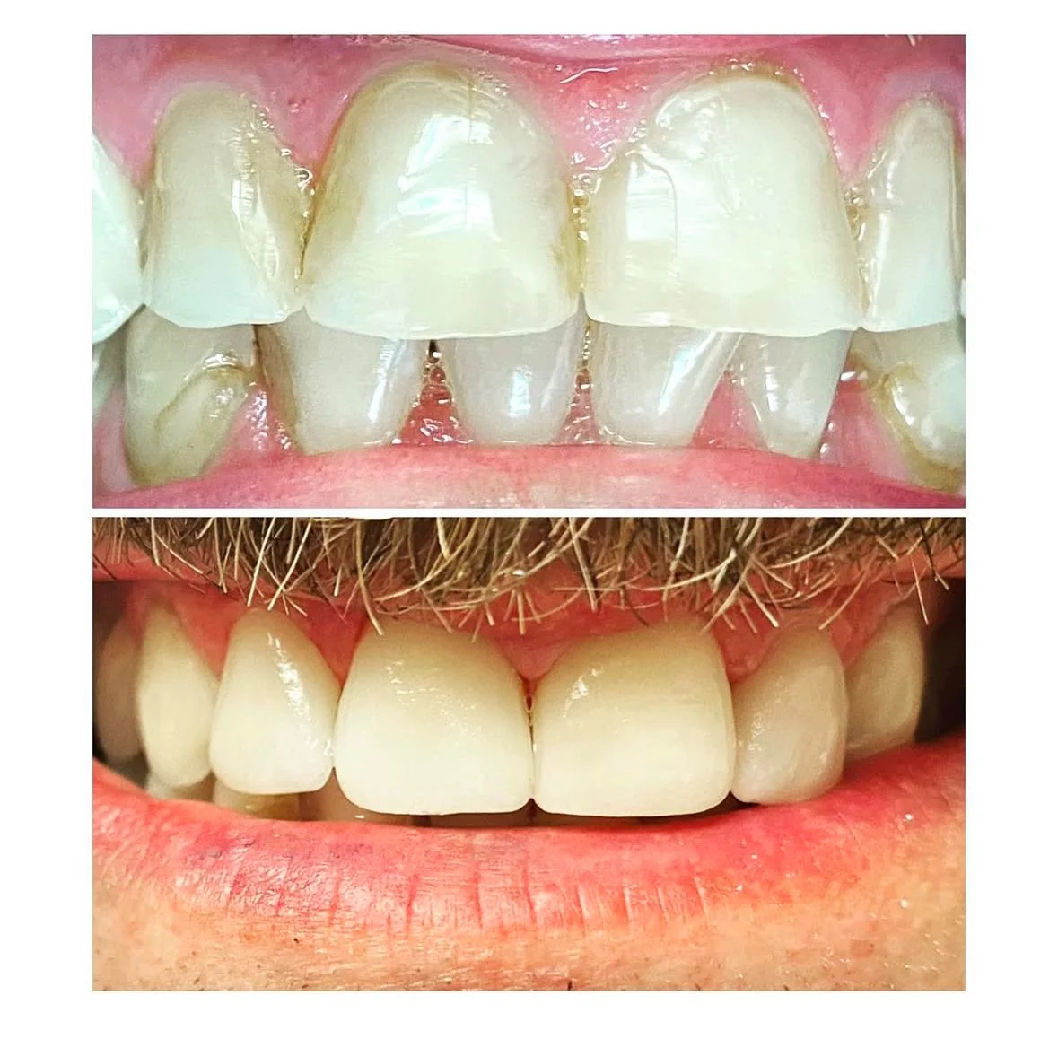 MFD_Cosmetic Crowns 3.jpg