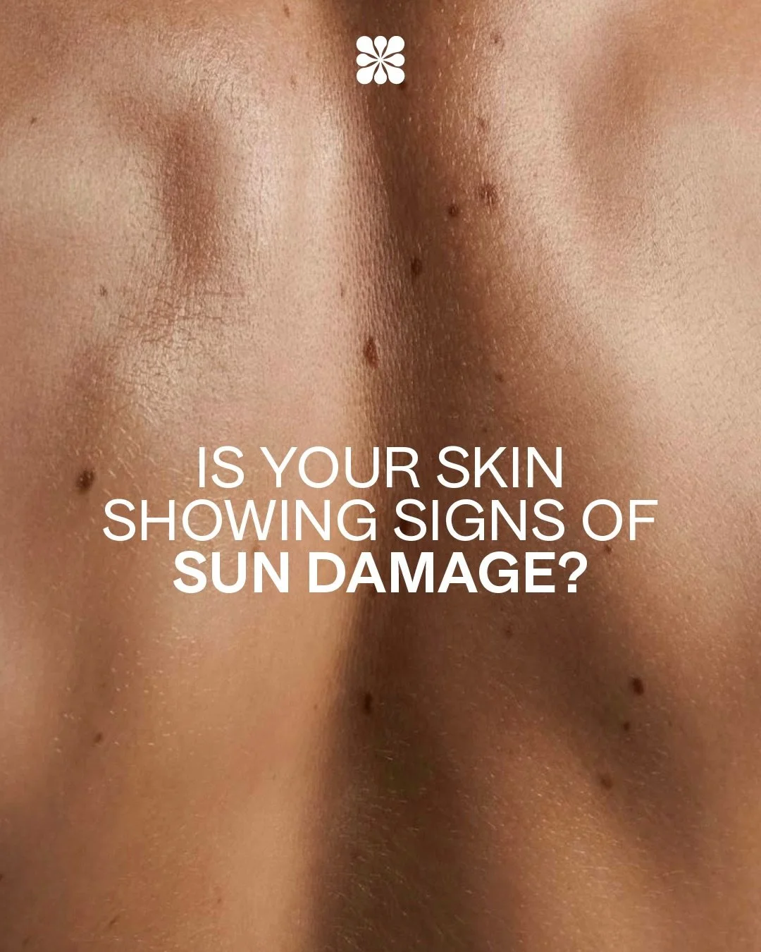 Sun damage shows up sooner than you think. ☀️ 

Skin Cancer Awareness Month is a reminder that SPF, daily habits, and regular check-ins make all the difference in protecting your skin and keeping it healthy long term. 

Book your consultation at Rhei