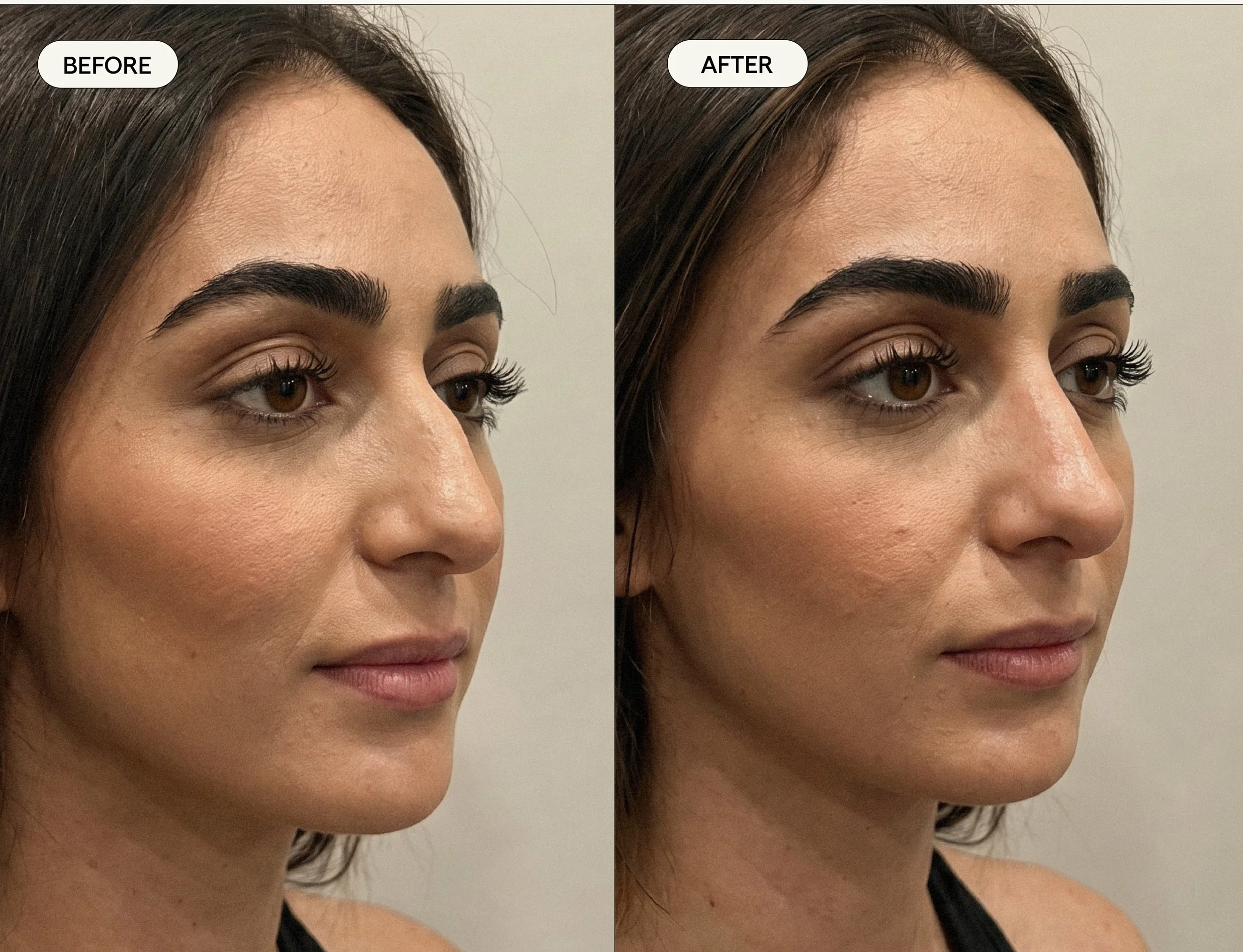Femal Facial Balancing.jpg