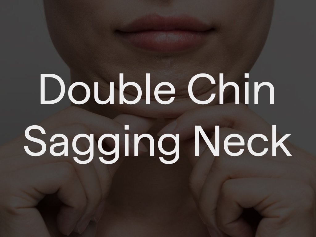 Close-up of a woman touching her double chin with her hands.