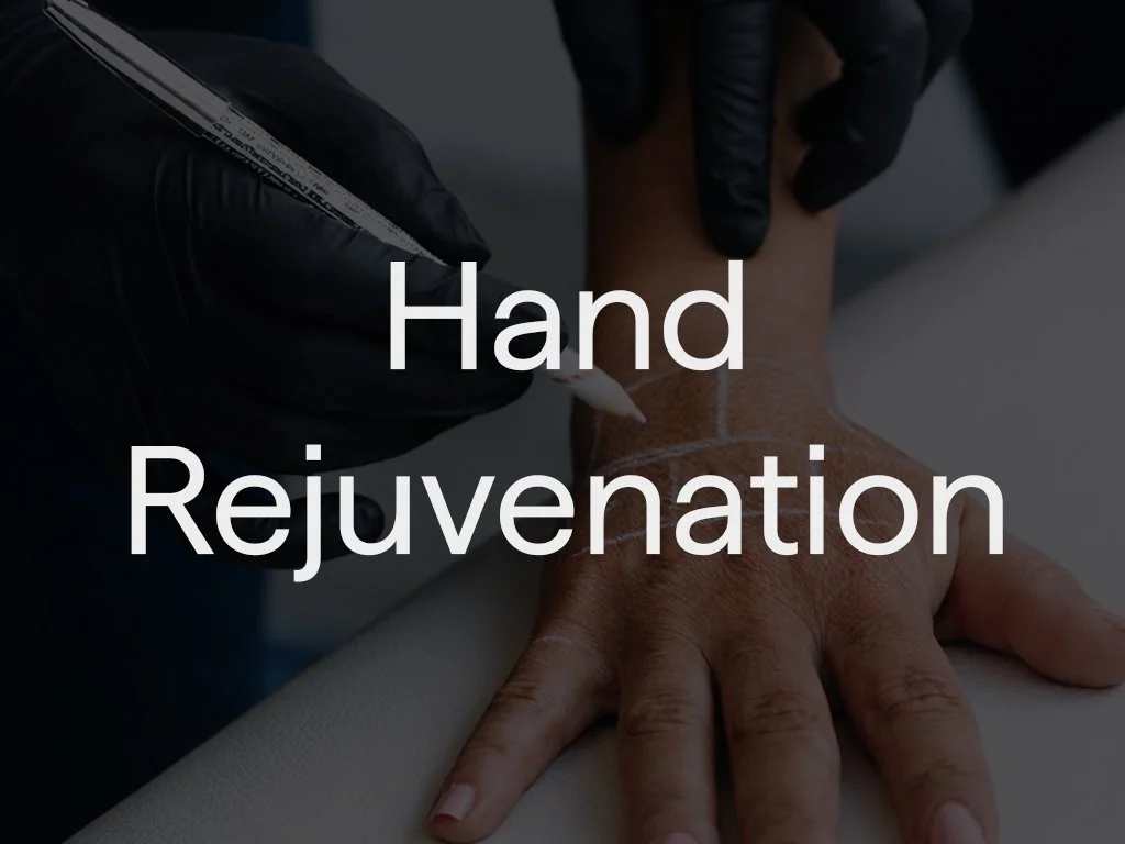 Hand rejuvenation restores a smoother, more youthful appearance to the hands. Treatment is tailored to each patient and may include biostimulators, skin hydrators, and laser therapy to improve texture, tone, and skin quality while reducing visible si