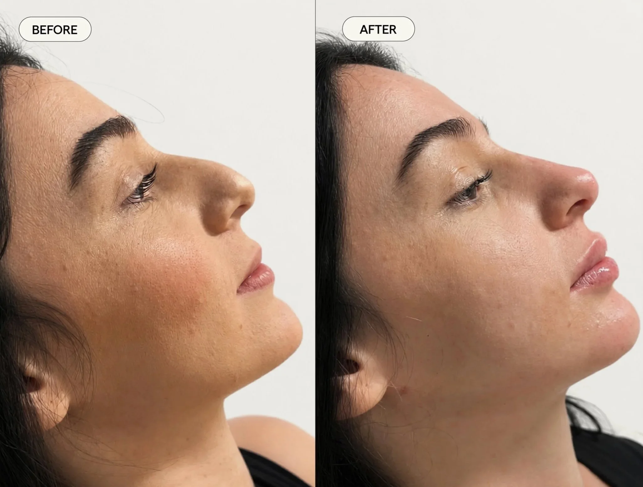 Facial+Haromy+01.jpg