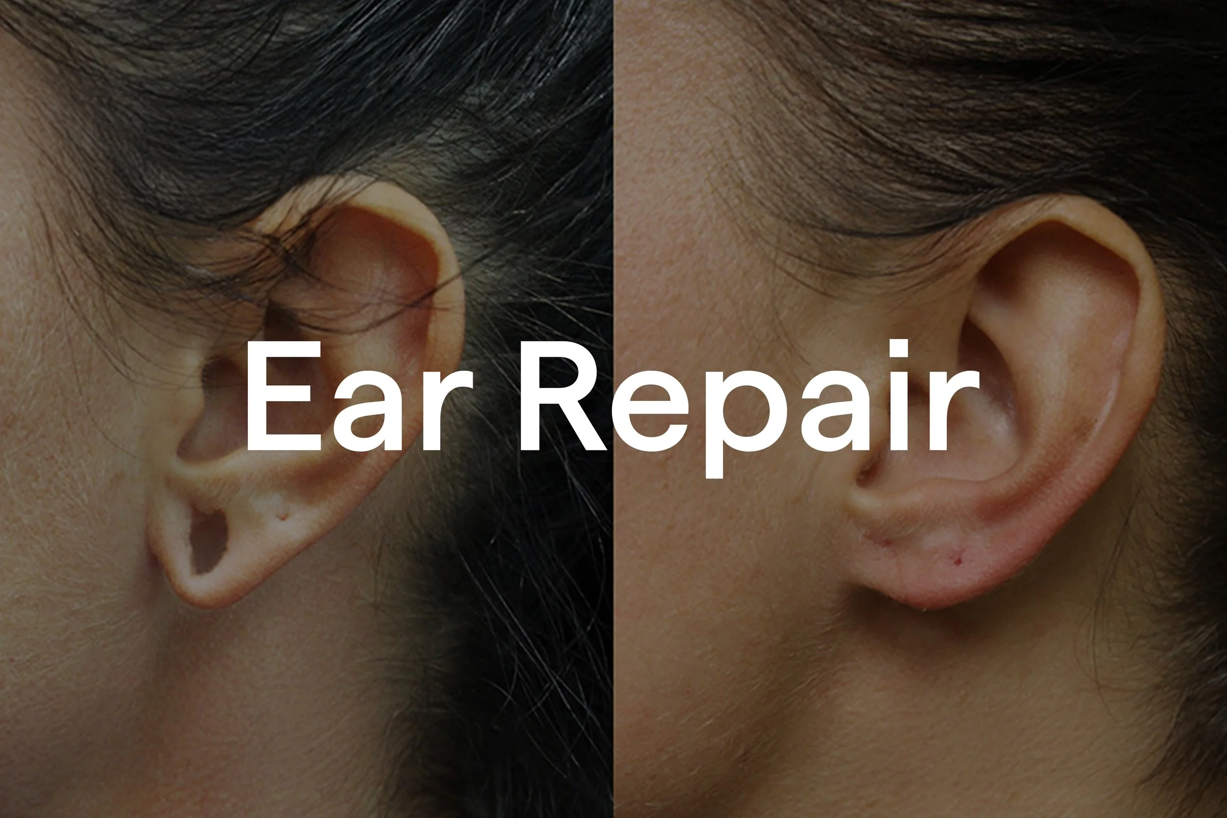 Ears.jpg