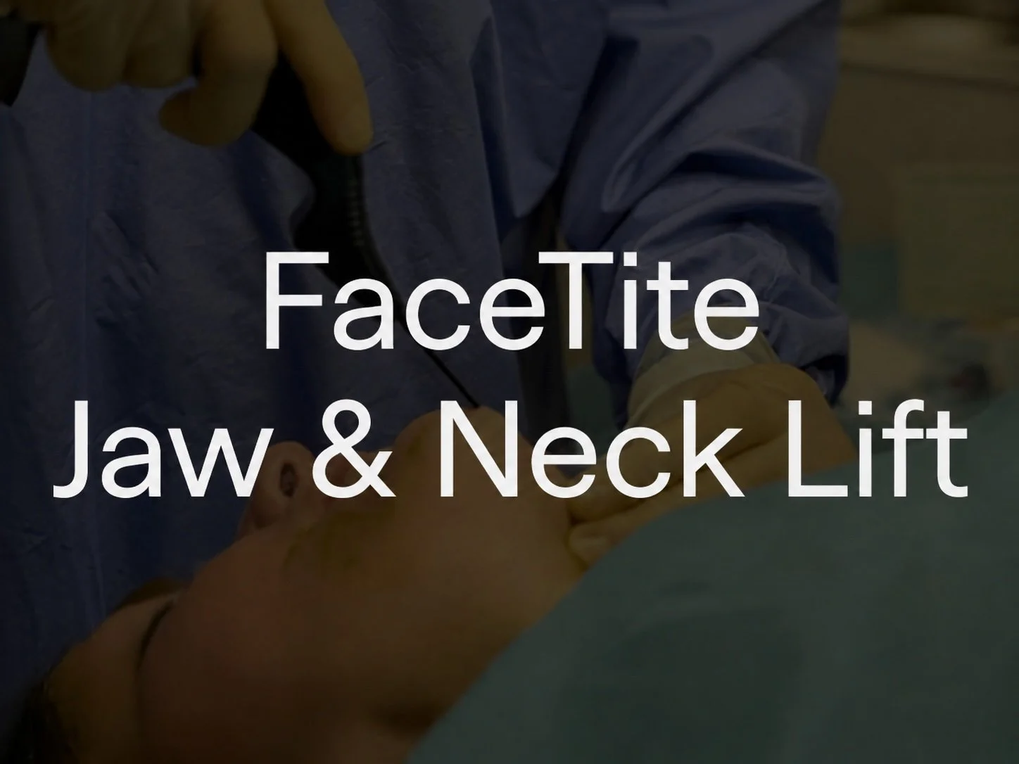 This delivers significant tightening and contouring of the lower face and jawline, offering results comparable to a lower facelift without the need for traditional surgery. Using advanced RF technology, it melts excess fat and contracts the skin to c