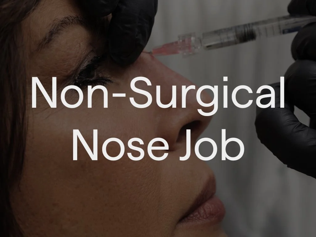 Non-surgical rhino uses dermal filler to reshape and refine the nose without surgery.  Smooth bumps, improve symmetry, and enhance nasal and facial profile. 