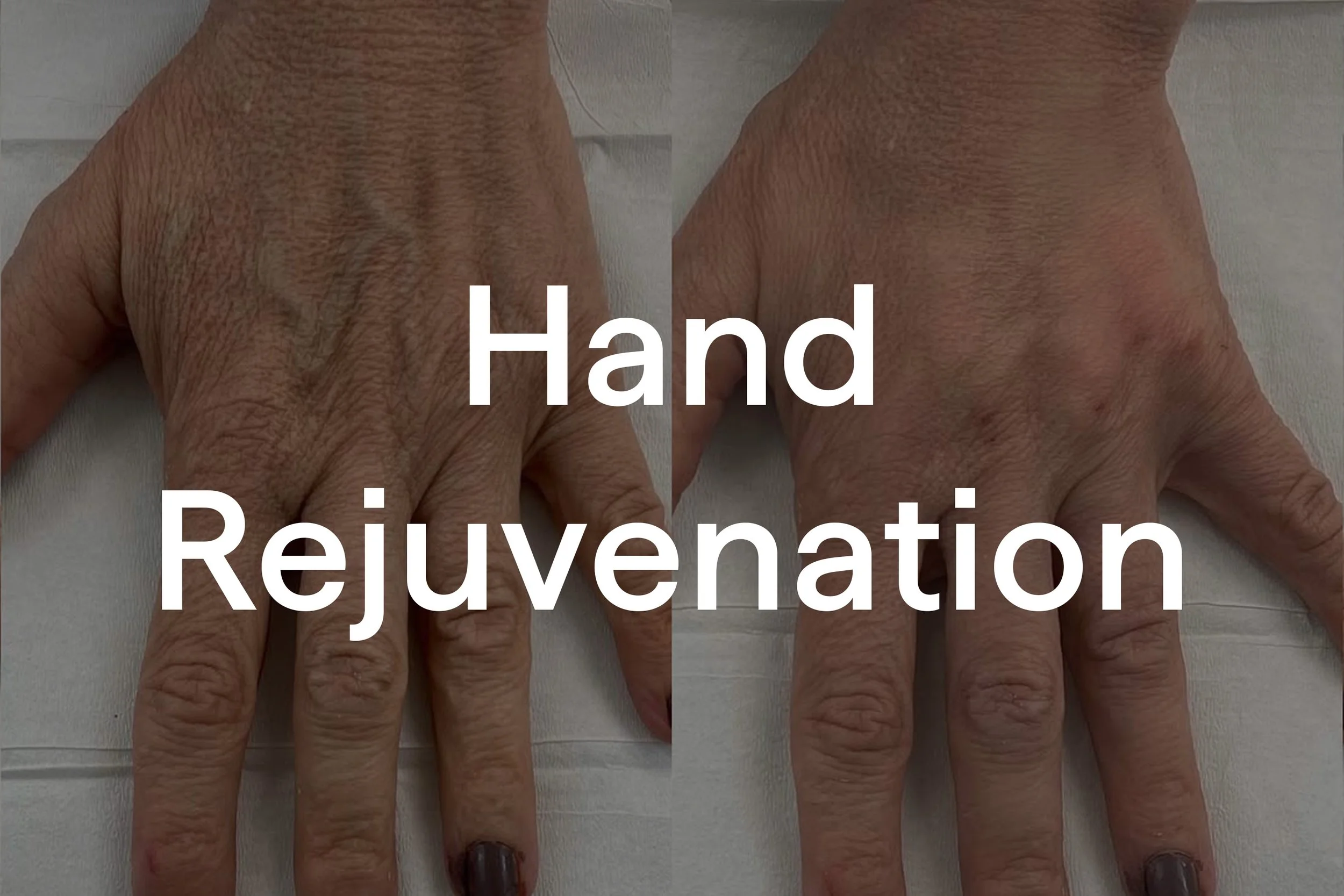 Hand_Rejuvenate.jpg