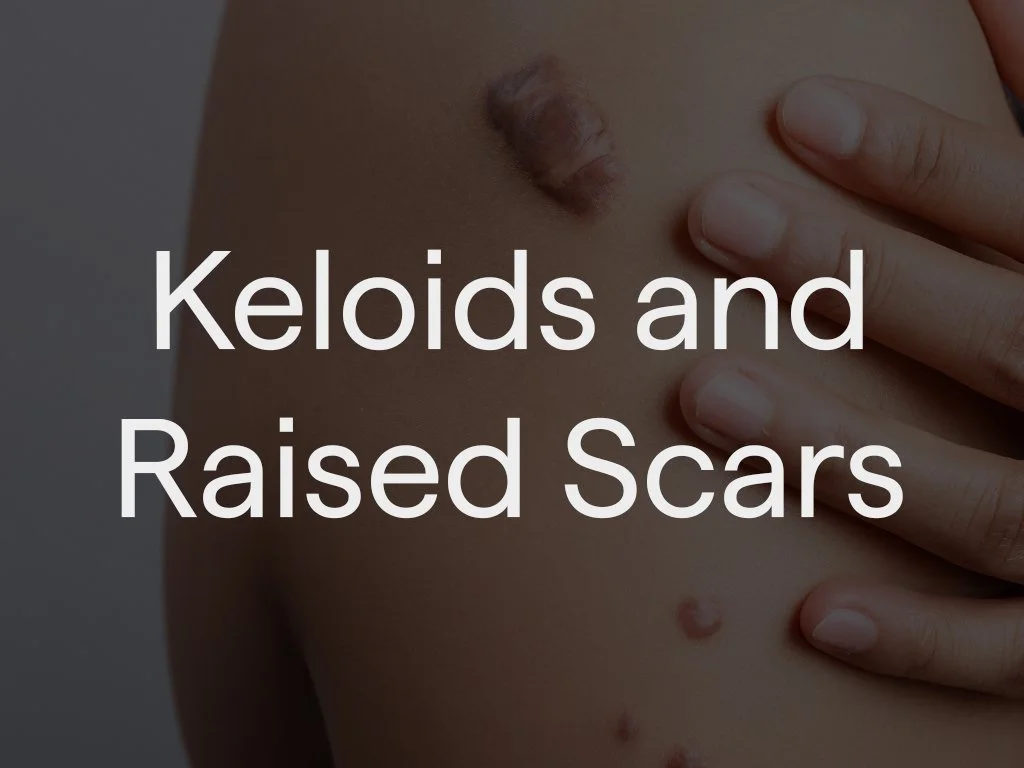 Keloid scars can be treated with targeted steroid injections, laser or minor surgical removal. Treatment aims to flatten the scar, reduce symptoms such as itching or discomfort, and improve overall appearance while minimising recurrence.