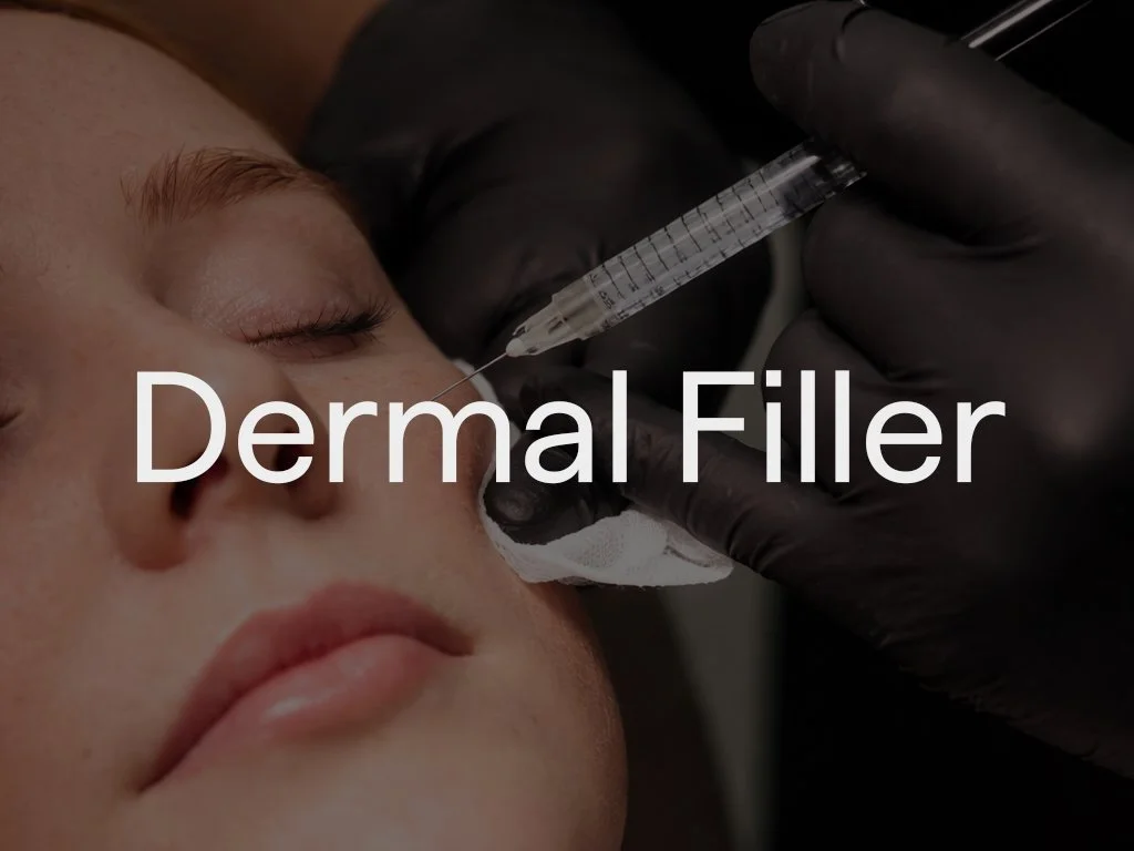 Dermal fillers are used to refresh the face and can also improve areas such as the hands and feet. They help reduce deep lines, restore lost volume, and smooth facial contours.