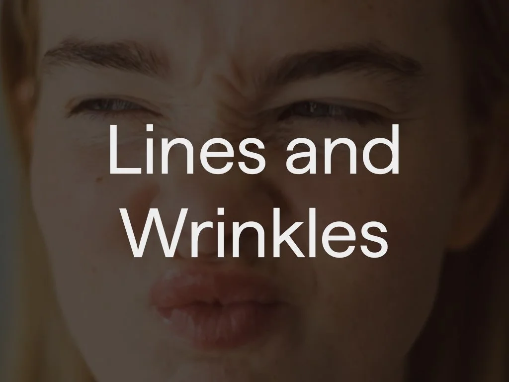 Close-up of a woman with visible lines and wrinkles on her face and pursed lips, with the text "Lines and Wrinkles" overlaid.