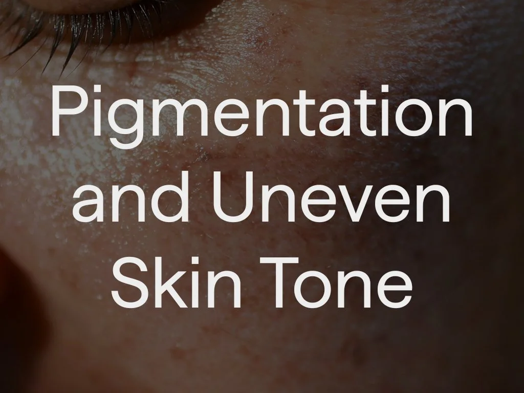 Close-up of skin showing pigmentation and uneven skin tone.