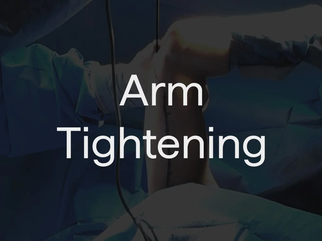Advanced arm contouring treatment is designed to firm and refine the upper arms without the need for traditional surgery. Using targeted aspirated fat and RF technology, excess fat is reduced while the skin is tightened from within, creating a smooth