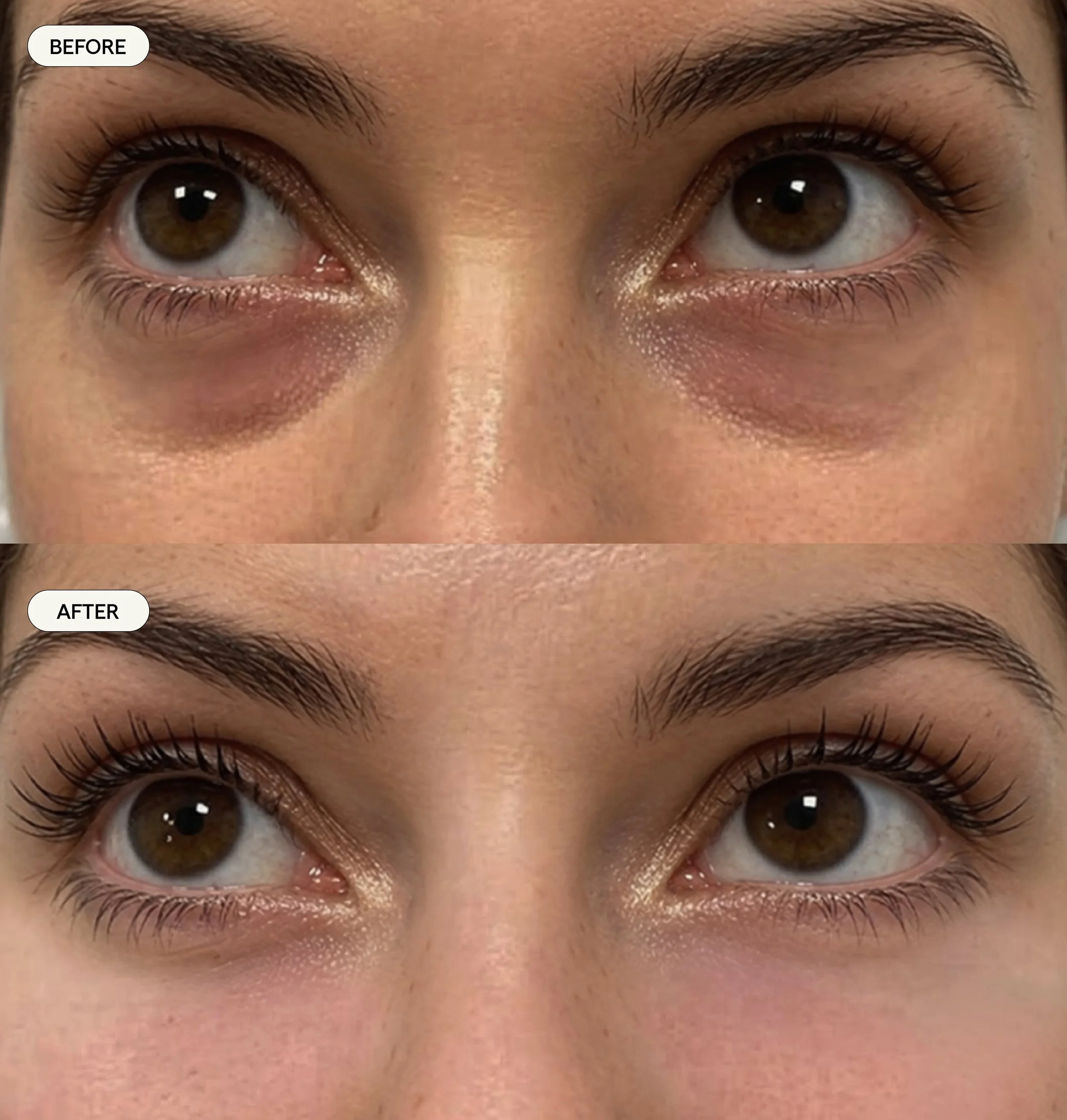 UnderEyes.jpg