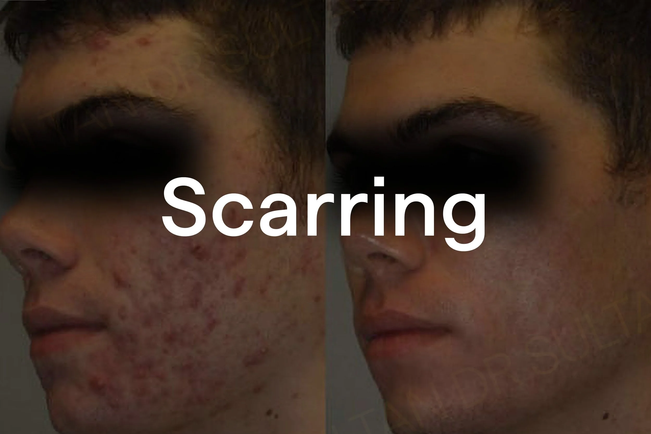 Scars.jpg