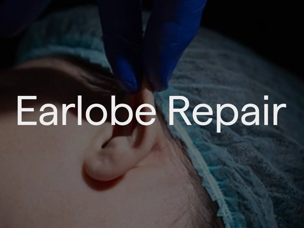 Earlobes are commonly stretched or torn as a result of wearing heavy earrings or during trauma. Stretched earlobes can also be caused as a result of wearing ear lobe discs as a fashion.