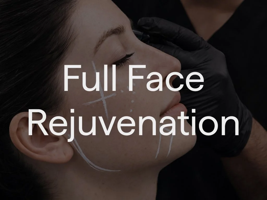 Full Face Rejuvenation by Dr Sultan takes a structured, mathematical approach to ageing by carefully adding and reducing volume in specific areas to lift, tighten, and refine the facial contours.