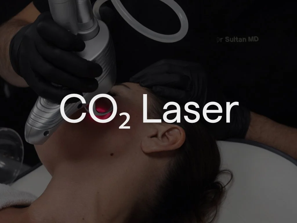 The powerful Lumenis CO₂ laser is used to improve scars, including acne, remove moles, and tighten the skin - face, eyes, neck. It works by resurfacing the skin and stimulating collagen production. This treatment is particularly effective for deep, p