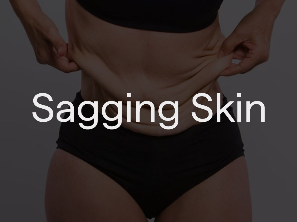 Person pinching loose skin on their abdomen.