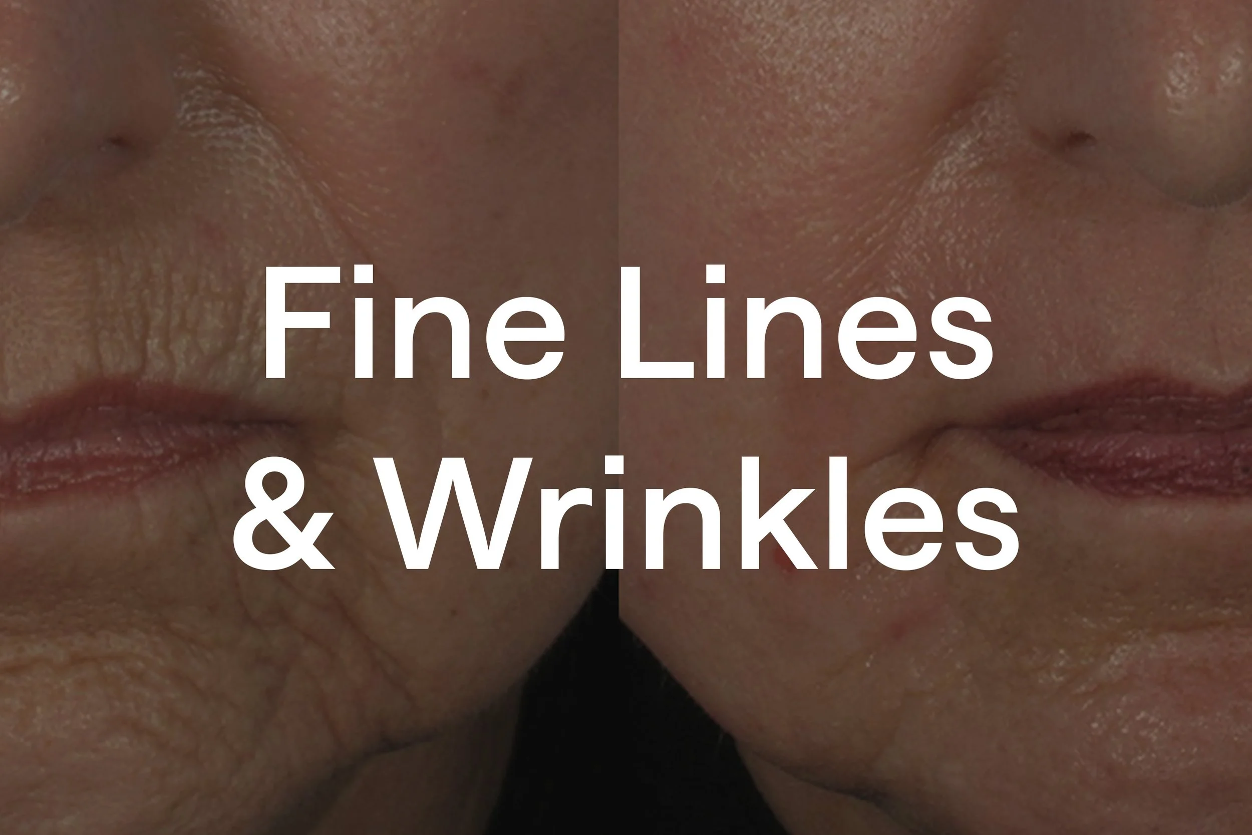 Lines and Wrinkles.jpg
