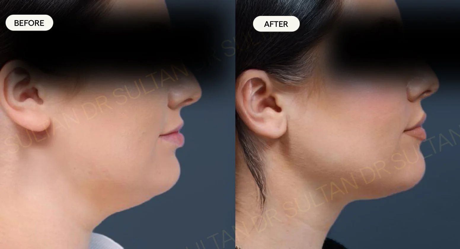 Quantum_Neck_03_WM.jpg