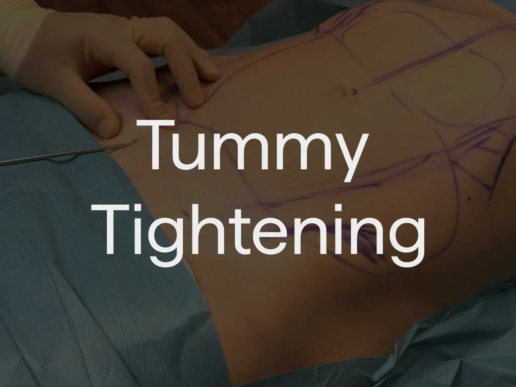 Dr Sultan's tummy tightening treatment is designed to firm and refine the abdomen without the need for traditional surgery. Using targeted aspirated fat and RF technology, excess fat is reduced while the skin is tightened from within, creating a smoo