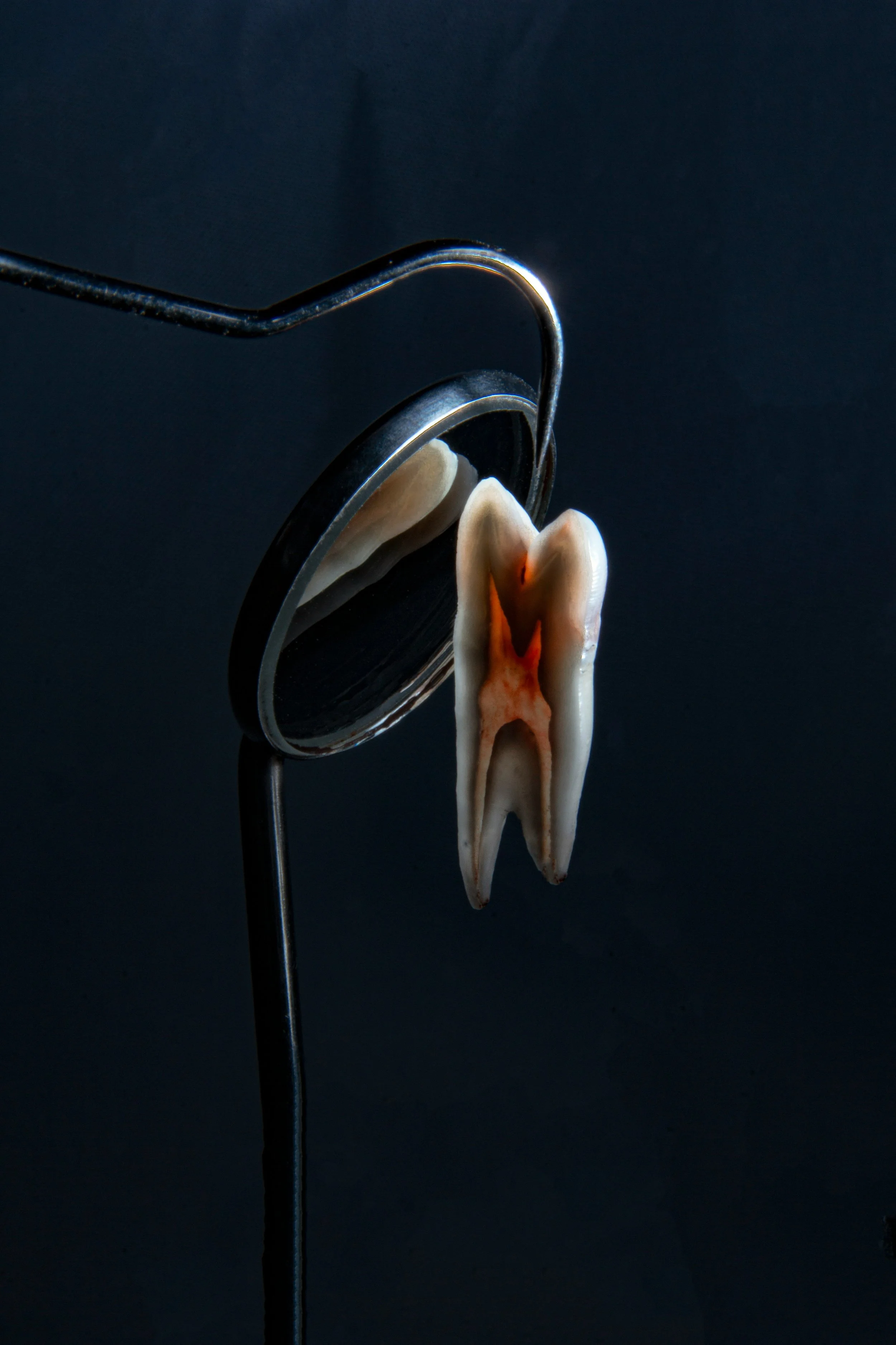 A dental mirror reflecting a molar tooth, which is positioned in front of the mirror.