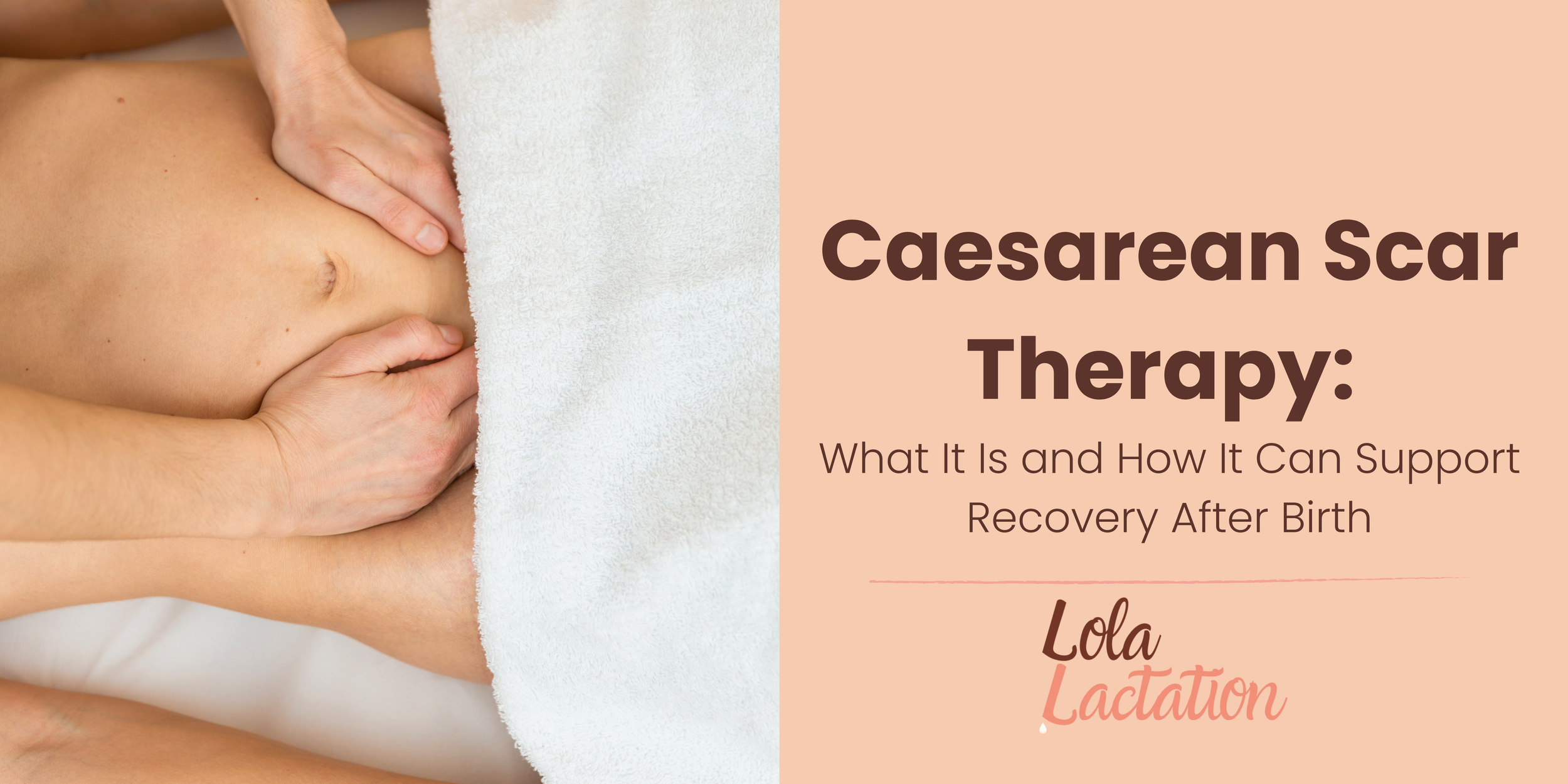 Caesarean Scar Therapy: What It Is and How It Can Support Recovery After Birth