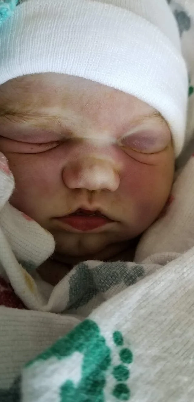 stillborn baby